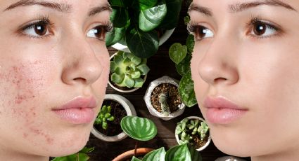 Con estas 4 plantas de tu jardín puedes preparar mascarillas para eliminar el acné