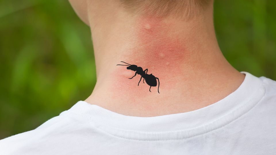 Ante la picadura de insectos, hay errores que debemos evitar. Fuente: producción Panorama