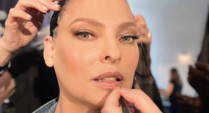 Cuál es el tratamiento estético que desfiguró a la supermodelo Linda Evangelista