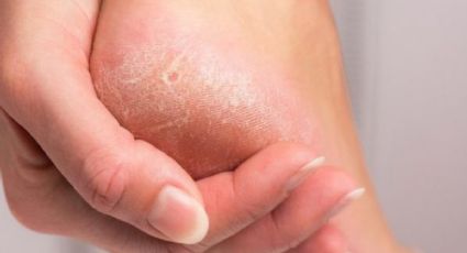 Pedicura: este es el mejor remedio natural y casero para acabar con los talones agrietados