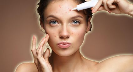 Productos de skincare que arruinan y dañan tu piel