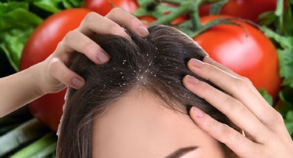 Cómo usar cáscara de tomate para eliminar la caspa y combatir la calvicie