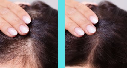 Olvídate de la caída del cabello y de las canas con el consumo de esta vitamina