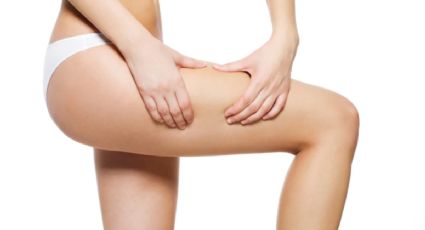 Cómo atacar la celulitis para que no invada nuestro cuerpo