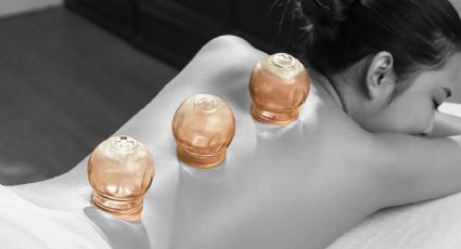 Conoce el 'cupping' la técnica que impuso la Rosalía y que quita años de tu rostro en una sola sesión