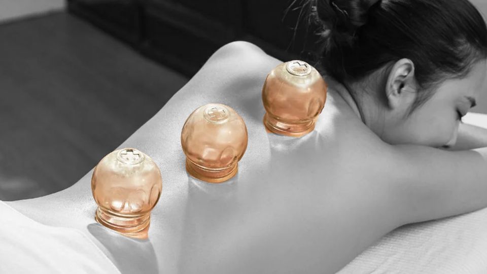 Cupping, el tratamiento para mantenerse joven de Rosalía. Fuente: instagram @rosalia.vt