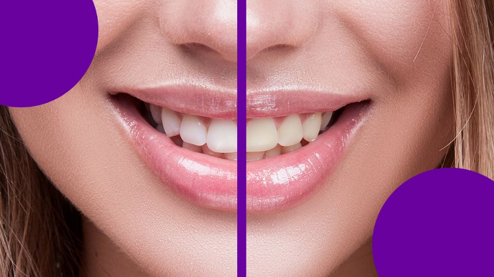 El truco secreto que ayuda a blanquear los dientes amarillos. Fuente: producción Panorama/Shutterstock