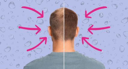 3 remedios caseros para la caída de pelo que prometen ser mejores que la vacuna contra la alopecia