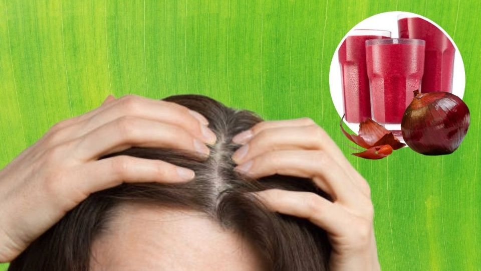 La cebolla contiene propiedades activas para eliminar las canas. Fuente: producción Panorama España