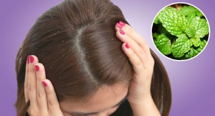 Elimina la caspa de tu cabello con este remedio natural a base de menta