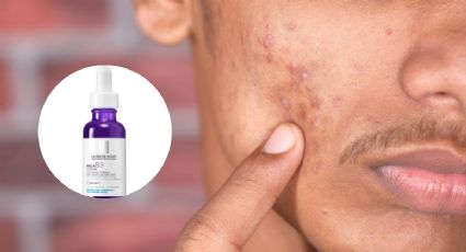 Corrige las manchas en la piel con este serum facial