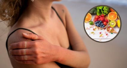 Las vitaminas que debes tomar para prevenir el cáncer de piel